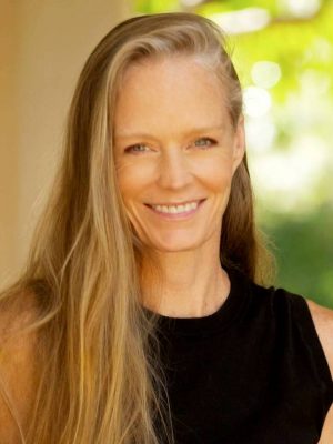 Suzy Amis